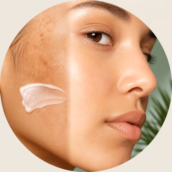 Dark Spots
